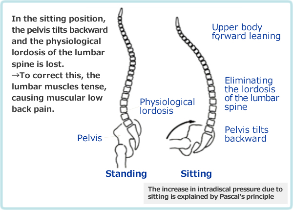 坐位による腰椎の生理的前弯の消失