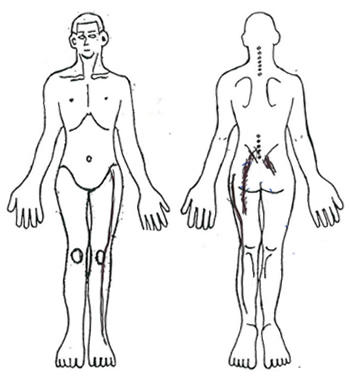 Findings in the lower back and lower extremities