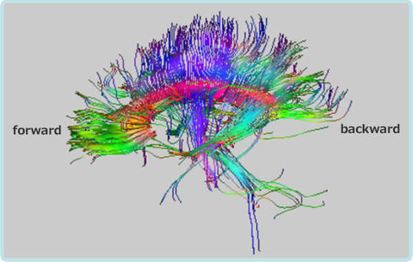 Fiber tractography image